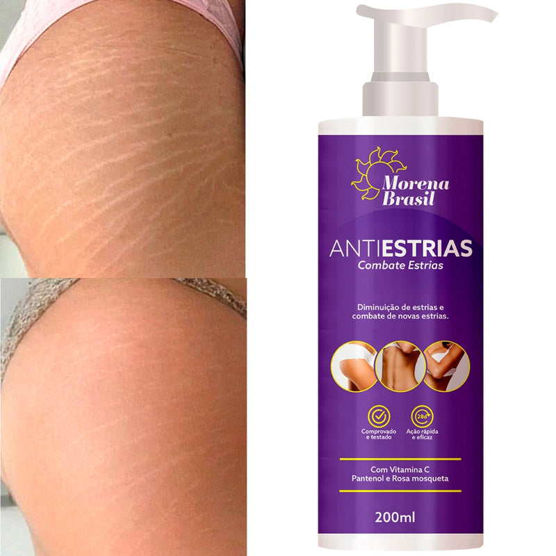 Creme Anti-Estrias