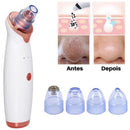 Removedor Cravos e Espinhas