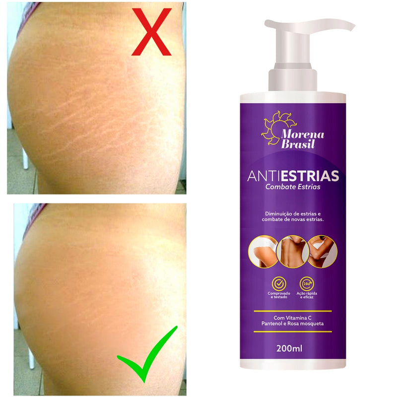 Creme Anti-Estrias