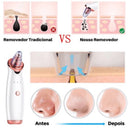 Removedor Cravos e Espinhas