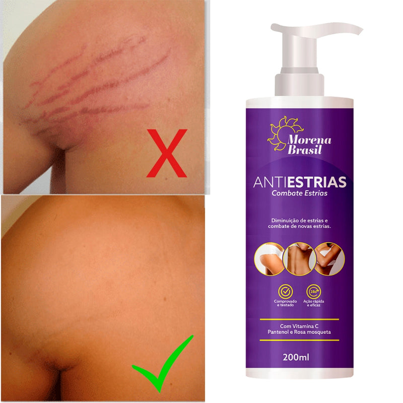 Creme Anti-Estrias